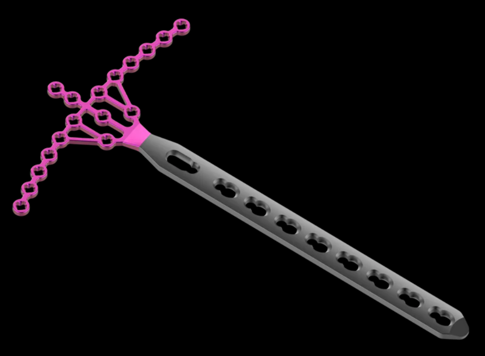 VARIABLE ANGLE PLATES